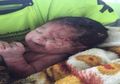 Ditemukan Tergeletak di Rumput, Ternyata Bayi Ini Selamat Keluar dari Rahim Ibunya yang Tewas saat Kecelakaan