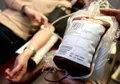 Penderita Hepatitis A dan B Tidak Boleh Donor Darah, Ini Alasannya!