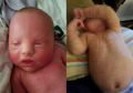Kulit Bayi Ini Menebal dan Berganti Setiap Minggu Seperti Ular, Ternyata Ini Penyebabnya