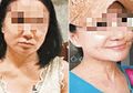 Terlilit Utang Miliaran, Perempuan 60 Tahun ini Operasi Plastik Agar Terlihat Berusia 20-an