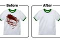 Enggak Pakai Repot, Noda Darah Di Baju Bisa Langsung Hilang Saat Dicuci dengan Bahan Dapur Murah Ini