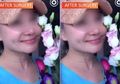 Terlihat Cantik dan Muda, Wanita Ini Ternyata Nenek-nenek yang Menjalani Operasi Plastik dan Jadi Buronan Polisi!