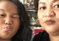 Anak Tike Priyatnakusumah Pernah Didiagnosis Terkena Diabetes, Ini Cara Jitu Mencegah Diabetes Pada Anak