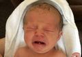 Super Langka, Bayi Ini Punya Gigi Sejak Lahir, Ini Kata Ahli