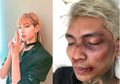 Heboh Young Lex Babak Belur di MnG Lisa BLACKPINK, Fans K-pop Ragukan 5 Hal Ini!