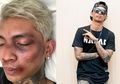 Kabar Young Lex Bonyok Disebut HOAKS, Apa Hukuman bagi Pembuatnya?