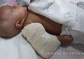 Terjadi Lagi, Bayi 3 Bulan Alami Patah Tulang di Tangan Pengasuhnya, Ini Penyebabnya!