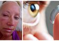 Tragis, Pakai Contact Lens Saat Mandi, Wanita Ini Kehilangan Penglihatannya