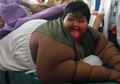 Ingat Bocah SD yang Beratnya 192 kg Karena Sering Makan Sambil Nonton, Begini Kondisinya Sekarang