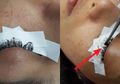 Ingin Bulu Matanya Terlihat Lentik, Mata Wanita Ini Justru Bengkak