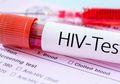 Benarkah Ciuman Bikin Tertular HIV/AIDS? Ini 5 Mitos dan Fakta Penularan HIV/AIDS