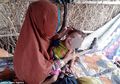 Derita Kanker Langka Anak 2 Tahun Ini Berisiko Mengalami Kebutaan