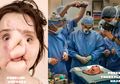 Kehilangan Sebagian Wajahnya, Perempuan Ini Lakukan Transplantasi Wajah, Lihat Hasilnya!