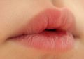 5 Bahan Alami Untuk Menghidrasi Kulit di Sekitar Bibir yang Kering