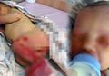 Penuh Luka Gigitan, Bayi Ini Ditemukan Masih Hidup di Hutan!