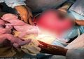 Divonis Tidak Punya Anak, Seorang Ibu Dengan Rahim Berbentuk Hati Malah Melahirkan Anak Kembar