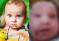 Bayi Ini Punya 50 Alergi, Dirinya Hanya Bisa Makan 4 Jenis Makanan!