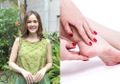 Enggak Nyangka! Cantik-Cantik, Cathy Sharon Alami Tumit Pecah-Pecah, Sampai Racik Ramuan Sendiri