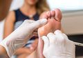 Terganggu dengan Kapalan di Kaki ? Coba Alternatif Berikut Ini!