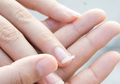 Tips Ampuh untuk Mencegah Kuku Agar Tak Mudah Patah, Mudah Kok!