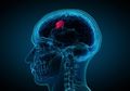Tanpa Kita Sadari Ternyata Tanda Ini Sinyalkan Kita Punya Tumor Otak!