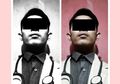 Demi Unggah Foto di Facebook, Pemuda 25 Tahun Nekat Jadi Dokter Gadungan di RSUP Sanglah, Bali