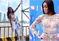Model Victoria's Secret Winnie Harlow Idap Vitiligo, Ini Penyebab dan Komplikasi dari Penyakit Ini