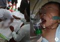 Seorang Bayi Meregang Nyawa Akibat Asap Rokok dari Ayahnya Sendiri