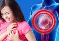 Tak Selalu Sedramatis, Tapi Ini 3 Gejala Serangan Jantung pada Wanita yang Wajib Kita Waspadai
