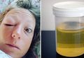 Setelah Rutin Meminum Air Kencing Perempuan Ini Sembuh dari Sakitnya, Ternyata Begini Caranya