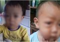 Mata Anak Ini Merah Hingga Berdarah Karena Radiasi Gadget, Awalnya Sang Ibu Tak Percaya!