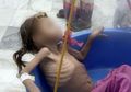 Nestapa Desa Terpencil di Yaman, Anak Anak Hanya Makan Daun Anggur