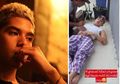 Ahmad Dhani Takut Al Mengidap Steven Johnsons Syndrome, Penyakit Apa Itu?