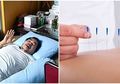 Mat Solar Jalani Akupuntur Untuk Sembuhkan Penyakit Stroke, 5 Penyakit Ini Juga Bisa