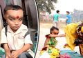 Punya Kelainan Medis, Bocah India Disembah dan Dianggap Titisan Dewa
