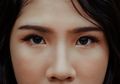 Miliki 'Hidung Jambu' Pembawa Hoki Ternyata Indikasi Penyakit Langka, Ini Gejalanya!