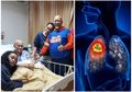Istri Indro Warkop Meninggal Dunia: 6 Makanan Mudah Didapat yang Bisa Mengurangi Risiko Kanker Paru-paru