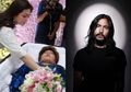Sakit Lambung Sebabkan Diana Nasution Meninggal: Ini 3 Buah-buahan yang Bisa Cegah Penyakit Tersebut