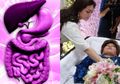 Sakit Lambung Diduga Penyebab Kematian Diana Nasution, Hindari Gaya Hidup Ini Untuk Mencegahnya