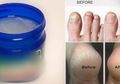 10 Manfaat Vaporub yang Jarang Diketahui, Bisa Atasi Tumit Pecah-pecah hingga Hilangkan Selulit