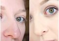 3 Masker Alami Ini Efektif Mengecilkan Pori-pori pada Wajah!