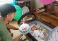 Bayi Tanpa Wajah, Divonis Bertahan Hidup 2 Minggu, Kemarin Ia Merayakan Ulang Tahun Pertamanya