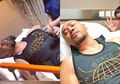 Alami Kecelakaan Sehabis Latihan di Gym, Tulang Lengan Atas Deddy Corbuzier Lepas dari Bonggolnya