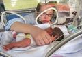 Berita Kesehatan Anak: Tidak Boleh Sembarangan, Inilah Perawatan Khusus dan Spesial Bayi Prematur