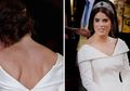 Putri Eugenie Bangga dengan Luka Bekas Operasinya: Ini Jenis dan Penyebab Skoliosis yang Pernah Diderita Sang Putri