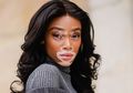Mengintip Gaya Fashion Model Vitiligo Winnie Harlow yang Stylish!