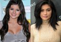 6 Seleb Hollywood Ini Dikabarkan Telah Melakukan Operasi Plastik