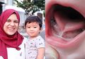 Putra Nycta Gina Alami Kelainan Bibir dan Lidah Hingga Tak Bisa Menyusu, Operasi Jadi Jalan Keluarnya