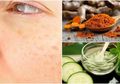 4 Obat Anti Flek Hitam karena Usia, Bisa Dibikin Sendiri Lho!