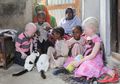 Diskriminasi Tinggi, Albino di Afrika Selatan Hidup dalam Ketakutan